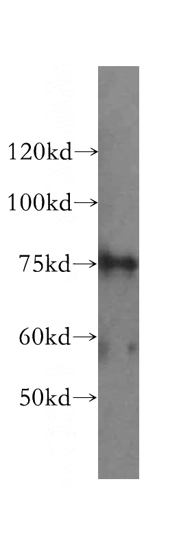 HeLa cells were subjected to SDS PAGE followed by western blot with Catalog No:114721(RLIM antibody) at dilution of 1:500