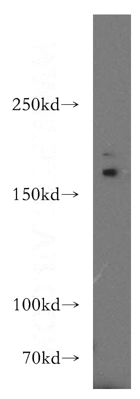 mouse skeletal muscle tissue were subjected to SDS PAGE followed by western blot with Catalog No:107780(ADCY3 antibody) at dilution of 1:300
