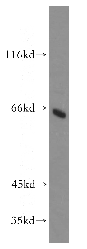 HepG2 cells were subjected to SDS PAGE followed by western blot with Catalog No:111261(C4orf15 antibody) at dilution of 1:500