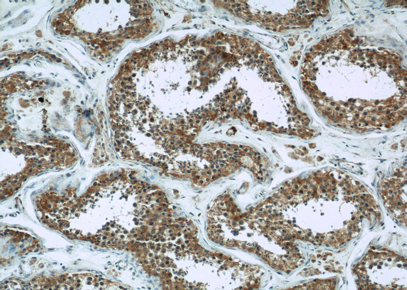 Immunohistochemical of paraffin-embedded human testis using Catalog No:111306(HK1 antibody) at dilution of 1:100 (under 10x lens)