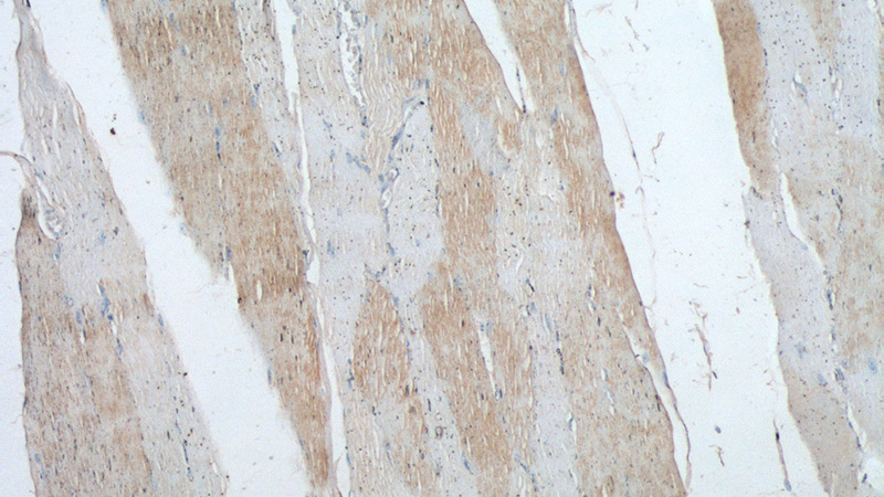 Immunohistochemistry of paraffin-embedded human skeletal muscle tissue slide using Catalog No:116150(TNNI1 Antibody) at dilution of 1:50 (under 10x lens)