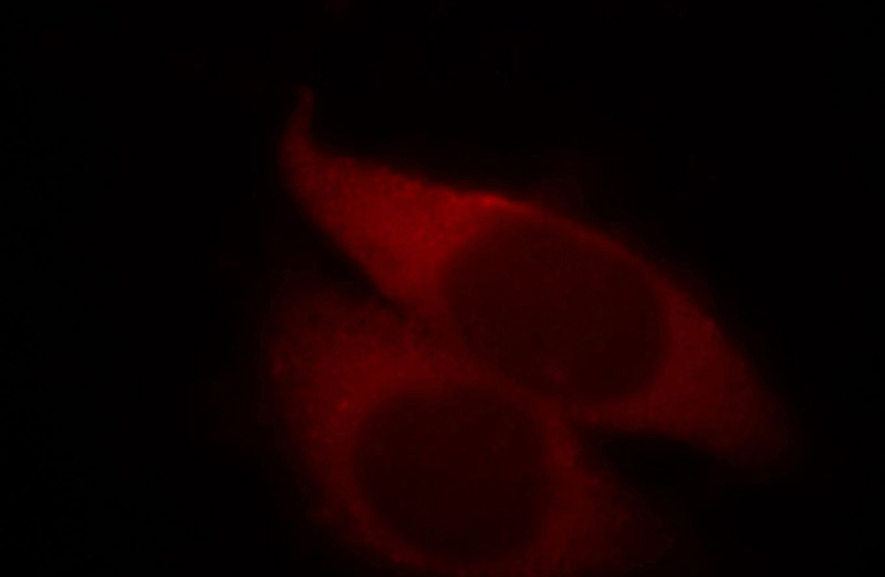 Immunofluorescent analysis of MCF-7 cells, using GDI2 antibody Catalog No: at 1:25 dilution and Rhodamine-labeled goat anti-mouse IgG (red).
