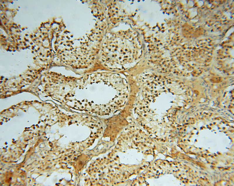 Immunohistochemical of paraffin-embedded human testis using Catalog No:111374(HDAC2-specific antibody) at dilution of 1:50 (under 10x lens)