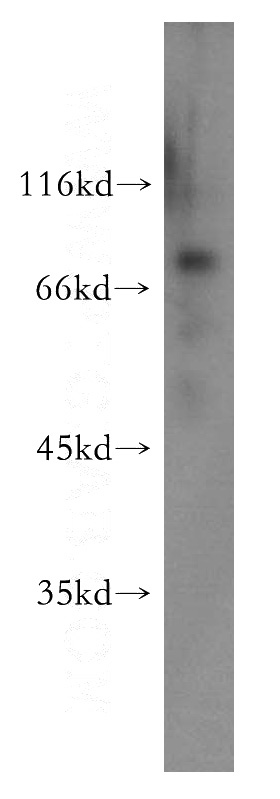 human brain tissue were subjected to SDS PAGE followed by western blot with Catalog No:114848(RSPH3 antibody) at dilution of 1:600