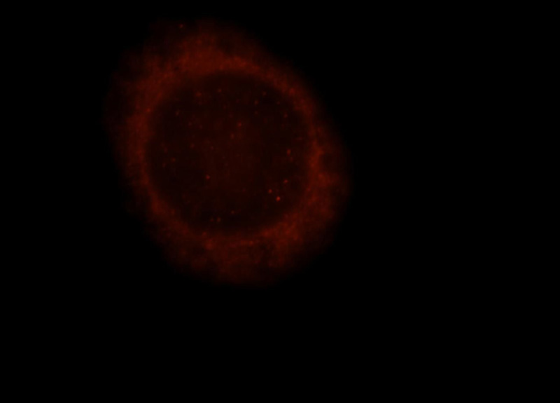 Immunofluorescent analysis of Hela cells, using HYAL2 antibody Catalog No:111575 at 1:25 dilution and Rhodamine-labeled goat anti-rabbit IgG (red).