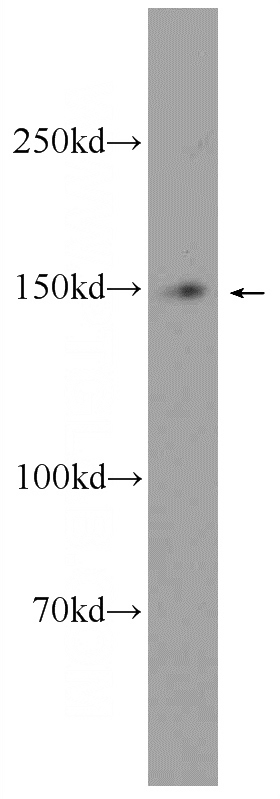 SW 1990 cells were subjected to SDS PAGE followed by western blot with Catalog No:112786(MTMR3 Antibody) at dilution of 1:300