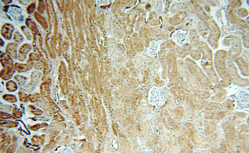 Immunohistochemical of paraffin-embedded human kidney using Catalog No:111021(GLI2-Specific antibody) at dilution of 1:50 (under 10x lens)