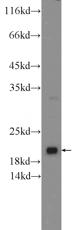 fetal human brain tissue were subjected to SDS PAGE followed by western blot with Catalog No:108147(ARL8B Antibody) at dilution of 1:600