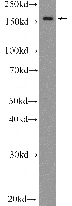 HEK-293 cells were subjected to SDS PAGE followed by western blot with Catalog No:110392(EPRS Antibody) at dilution of 1:600