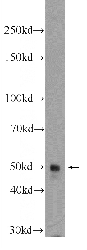 SGC-7901 cells were subjected to SDS PAGE followed by western blot with Catalog No:117138(BHLHE40 Antibody) at dilution of 1:600
