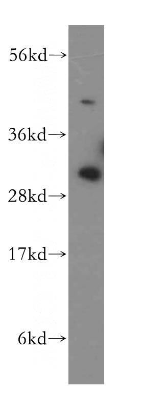 human heart tissue were subjected to SDS PAGE followed by western blot with Catalog No:115746(SURF1 antibody) at dilution of 1:500