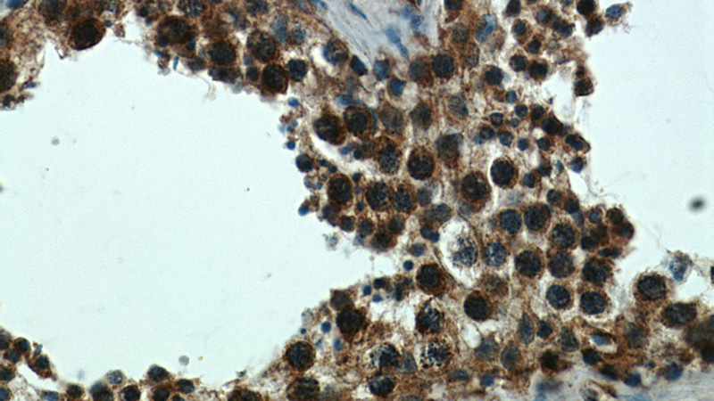 Immunohistochemical of paraffin-embedded human testis using Catalog No:108375(BBS7 antibody) at dilution of 1:50 (under 40x lens)