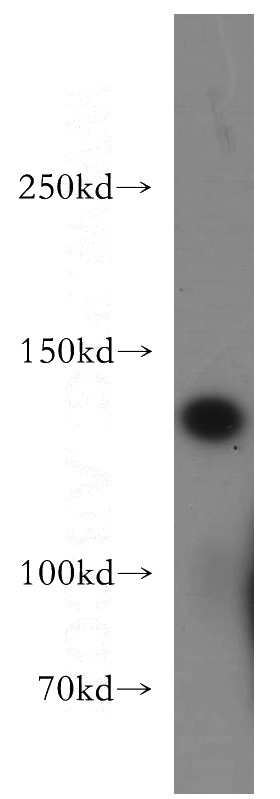 human testis tissue were subjected to SDS PAGE followed by western blot with Catalog No:109913(DGKK-Specific antibody) at dilution of 1:400