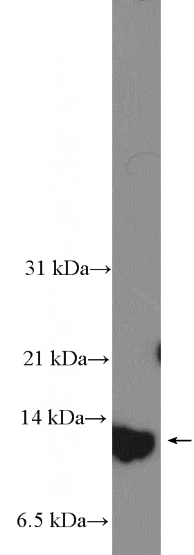 MCF-7 cells were subjected to SDS PAGE followed by western blot with Catalog No:114964(S100A7 Antibody) at dilution of 1:300