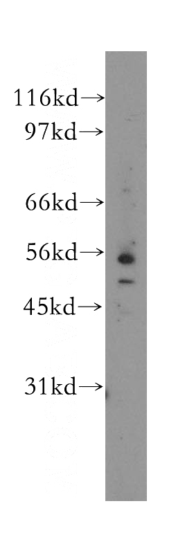 HeLa cells were subjected to SDS PAGE followed by western blot with Catalog No:110183(EIF2B3 antibody) at dilution of 1:300