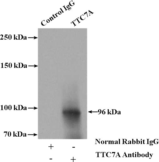 IP Result of anti-TTC7A (IP:Catalog No:116387, 4ug; Detection:Catalog No:116387 1:300) with K-562 cells lysate 4000ug.