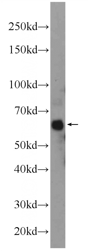 mouse skin tissue were subjected to SDS PAGE followed by western blot with Catalog No:113350(ONECUT2 Antibody) at dilution of 1:600