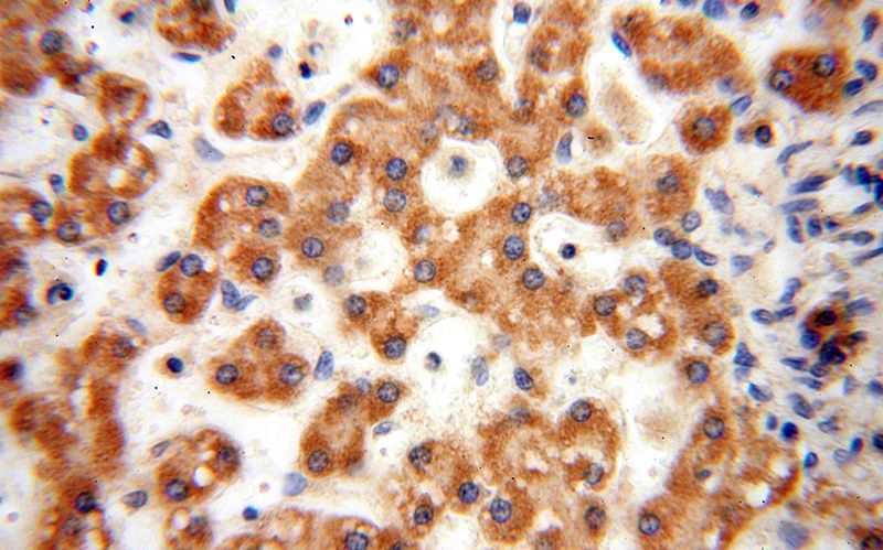 Immunohistochemical of paraffin-embedded human liver using Catalog No:108111(ANXA9 antibody) at dilution of 1:50 (under 40x lens)