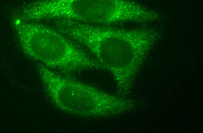 Immunofluorescent analysis of HepG2 cells, using SNAPIN antibody Catalog No:115449 at 1:50 dilution and FITC-labeled donkey anti-rabbit IgG (green).