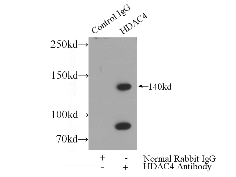 IP Result of anti-HDAC4 (IP:Catalog No:111377, 4ug; Detection:Catalog No:111377 1:500) with HeLa cells lysate 4000ug.