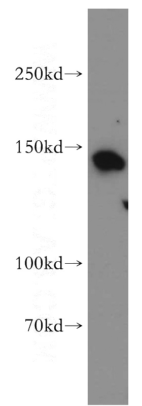 Raji cells were subjected to SDS PAGE followed by western blot with Catalog No:109730(CTR9 antibody) at dilution of 1:500