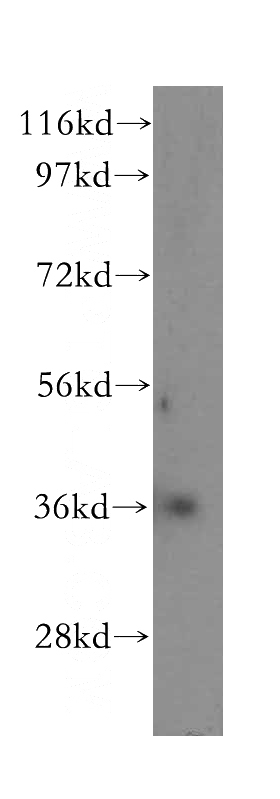 human kidney tissue were subjected to SDS PAGE followed by western blot with Catalog No:108743(CA11 antibody) at dilution of 1:400