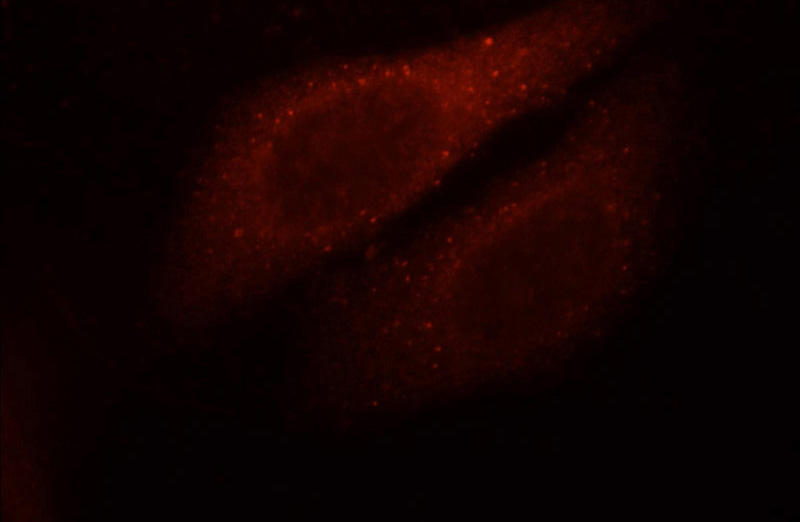 Immunofluorescent analysis of HepG2 cells, using GAGE2D antibody Catalog No:110825 at 1:25 dilution and Rhodamine-labeled goat anti-rabbit IgG (red).