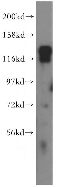 HeLa cells were subjected to SDS PAGE followed by western blot with Catalog No:115063(SAPS3 antibody) at dilution of 1:500