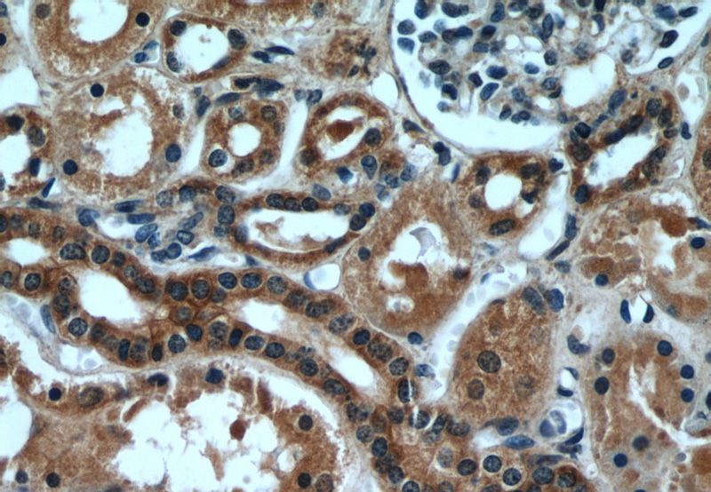 Immunohistochemical of paraffin-embedded human kidney using Catalog No:111335(hamartin antibody) at dilution of 1:50 (under 40x lens)