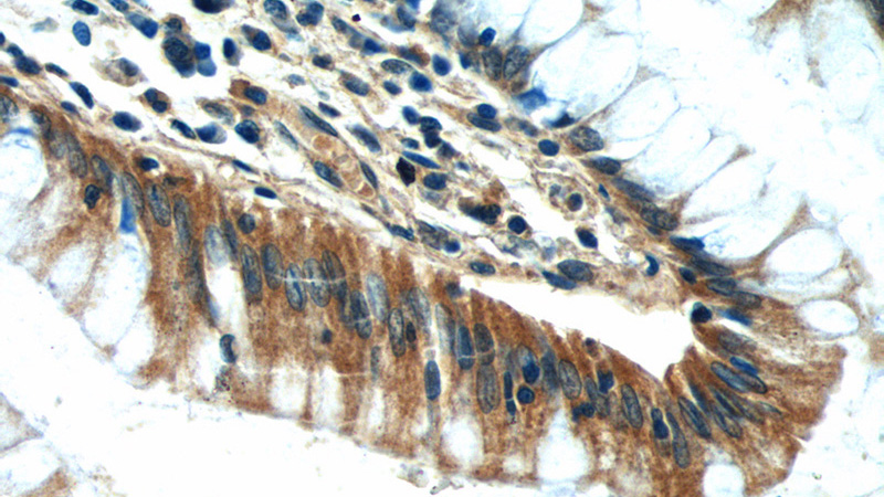 Immunohistochemistry of paraffin-embedded human colon tissue slide using Catalog No:109267(CEP164 Antibody) at dilution of 1:50 (under 40x lens)