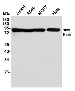 Western blot detection of Ezrin in Jurkat,A549,MCF7 and Hela cell lysates using Ezrin mouse mAb (1:2000 diluted).Predicted band size:69KDa.Observed band size:81KDa.