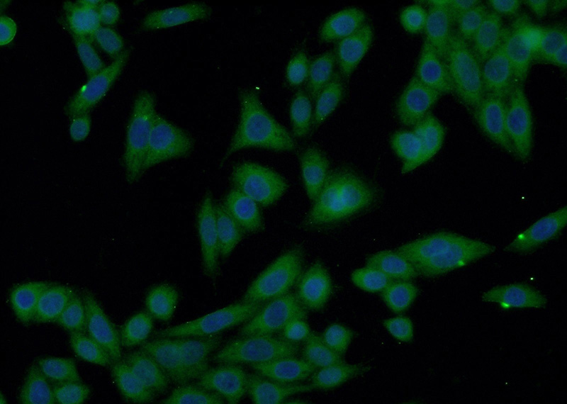 Immunofluorescent analysis of HeLa cells using Catalog No:116877(XRN1 Antibody) at dilution of 1:50 and Alexa Fluor 488-congugated AffiniPure Goat Anti-Rabbit IgG(H+L)