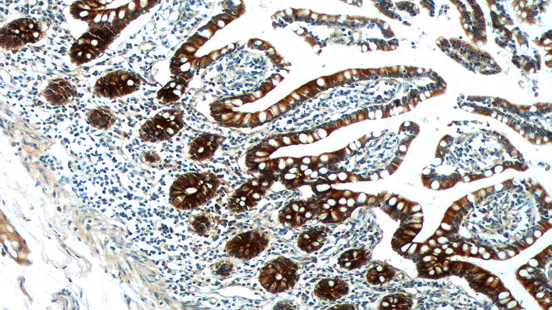 Immunohistochemistry of paraffin-embedded human small intestine tissue slide using Catalog No:113896(PIGR Antibody) at dilution of 1:200 (under 10x lens).