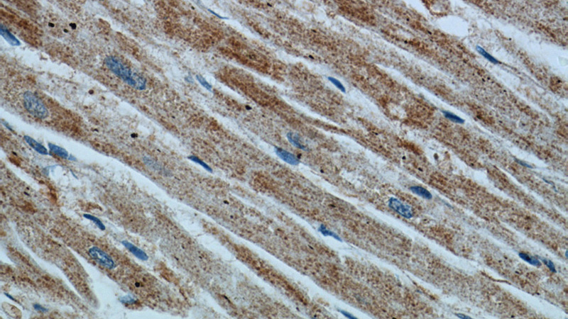 Immunohistochemical of paraffin-embedded human heart using Catalog No:108128(APAF1 antibody) at dilution of 1:50 (under 40x lens)