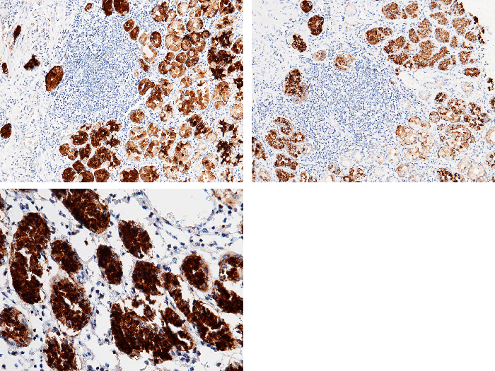 Pepsinogen C / PGC Antibody, Mouse MAb, Immunohistochemistry