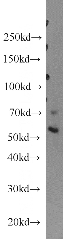 mouse ovary tissue were subjected to SDS PAGE followed by western blot with Catalog No:110369(ERO1L antibody) at dilution of 1:100
