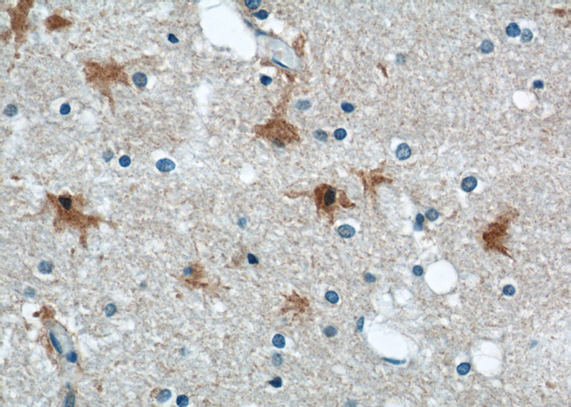 Immunohistochemical of paraffin-embedded human brain using Catalog No:110252(ENO1 antibody) at dilution of 1:100 (under 40x lens)