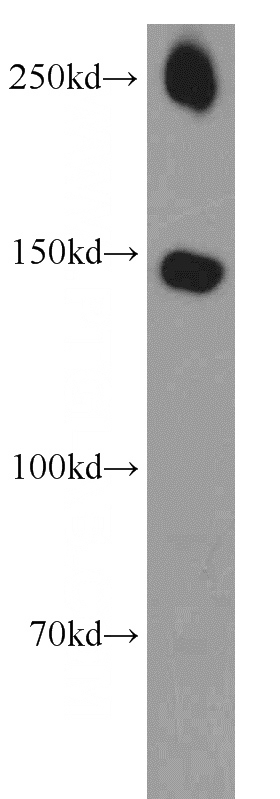 mouse brain tissue were subjected to SDS PAGE followed by western blot with Catalog No:115508(SOS1 antibody) at dilution of 1:500