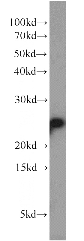 Jurkat cells were subjected to SDS PAGE followed by western blot with Catalog No:114800(POLR2E antibody) at dilution of 1:1000