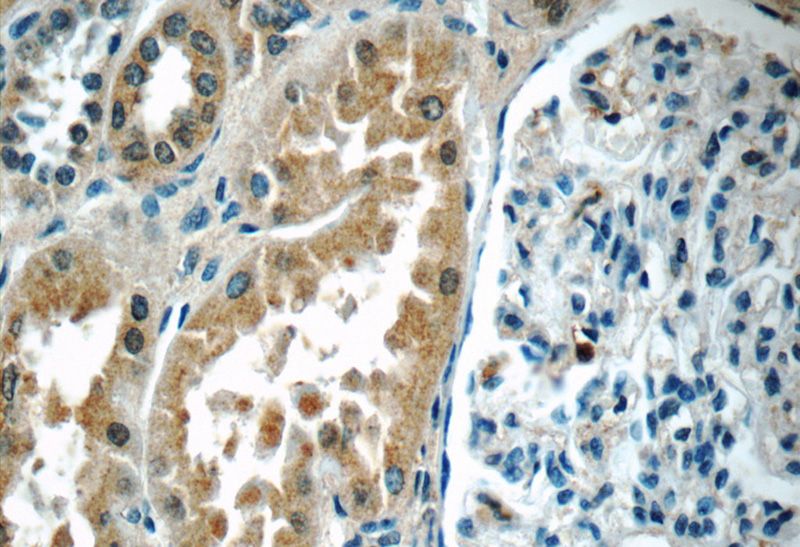 Immunohistochemistry of paraffin-embedded human kidney tissue slide using Catalog No:116417(TRPV4 Antibody) at dilution of 1:50 (under 40x lens)