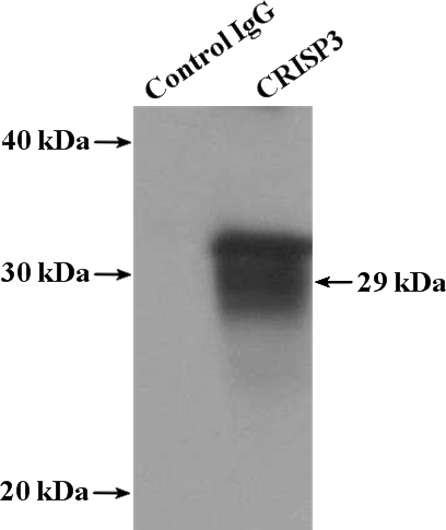 IP Result of anti-CRISP3 (IP:Catalog No:109564, 4ug; Detection:Catalog No:109564 1:300) with human placenta tissue lysate 1520ug.