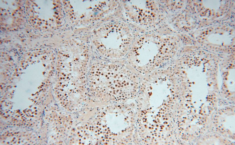 Immunohistochemical of paraffin-embedded human testis using Catalog No:114729(RNASEH2A antibody) at dilution of 1:50 (under 10x lens)