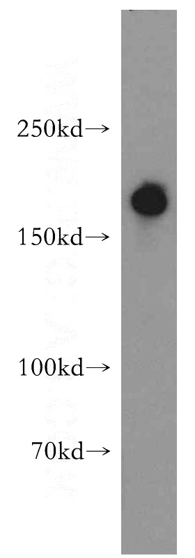 HT-1080 cells were subjected to SDS PAGE followed by western blot with Catalog No:114601(RBM16 antibody) at dilution of 1:2000