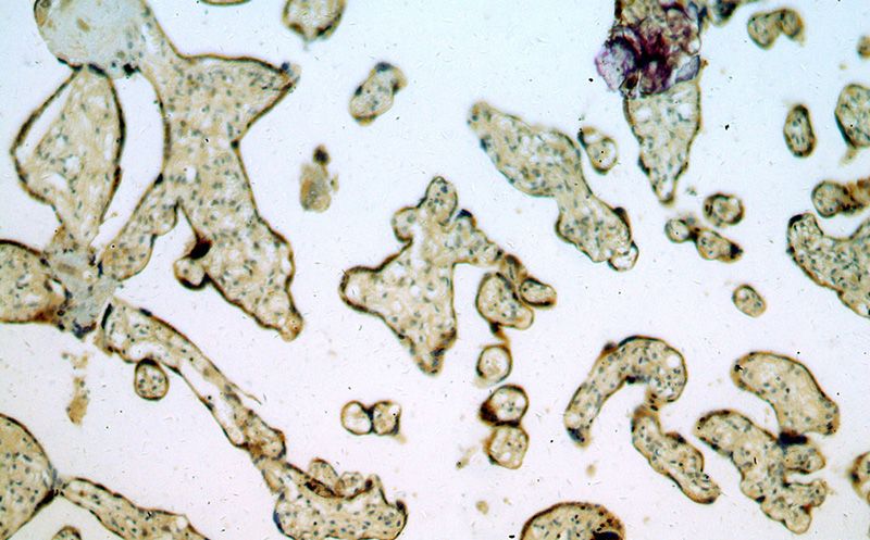 Immunohistochemical of paraffin-embedded human placenta using Catalog No:114621(REX2 antibody) at dilution of 1:50 (under 10x lens)