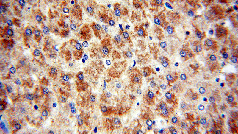 Immunohistochemical of paraffin-embedded human liver using Catalog No:113623(PDK1 antibody) at dilution of 1:50 (under 40x lens)