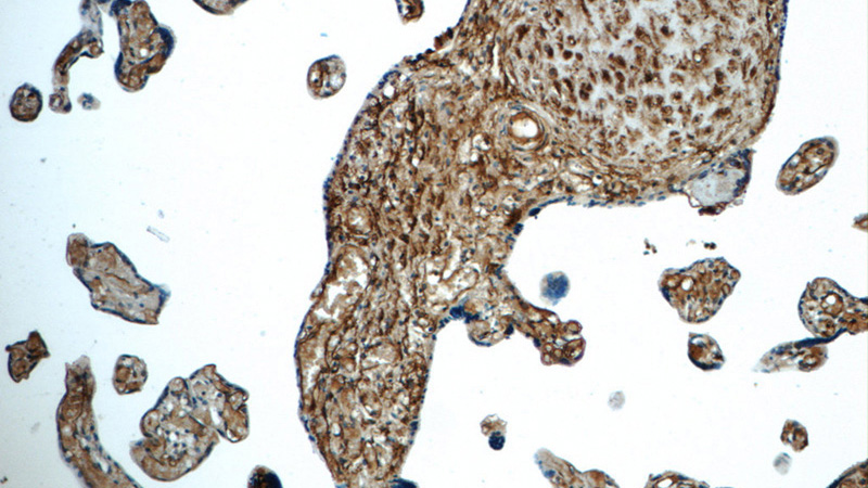 Immunohistochemistry of paraffin-embedded human placenta tissue slide using Catalog No:108003(AMPD3 Antibody) at dilution of 1:50 (under 10x lens)