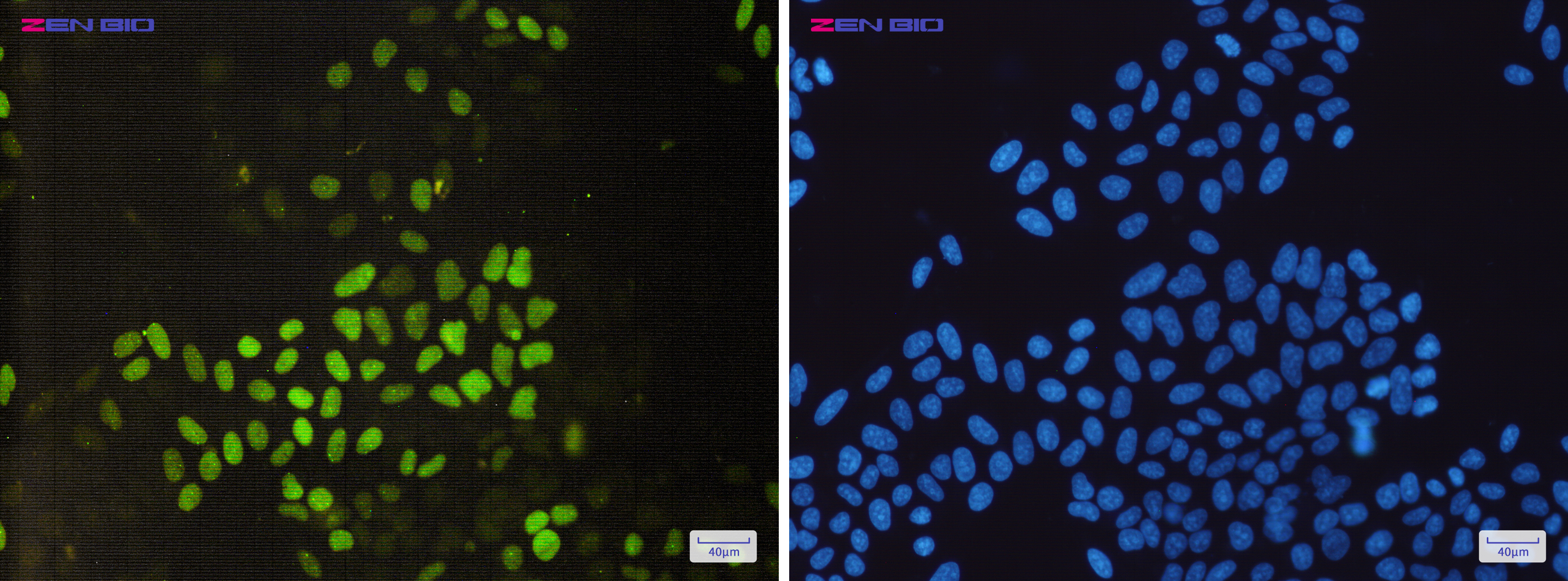 Immunocytochemistry of Cyclin E2(green) in Hela cells using Cyclin E2 Rabbit mAb at dilution 1/200, and DAPI(blue)
