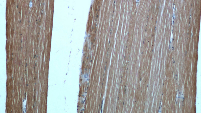 Immunohistochemical of paraffin-embedded human skeletal muscle using Catalog No:113566(PAMR1 antibody) at dilution of 1:50 (under 10x lens)