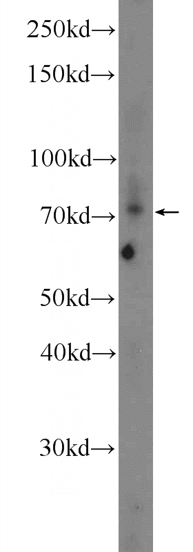PC-3 cells were subjected to SDS PAGE followed by western blot with Catalog No:107935(AKAP8L Antibody) at dilution of 1:300