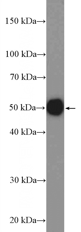 rat kidney tissue were subjected to SDS PAGE followed by western blot with Catalog No:107834(AGPAT9 Antibody) at dilution of 1:1500
